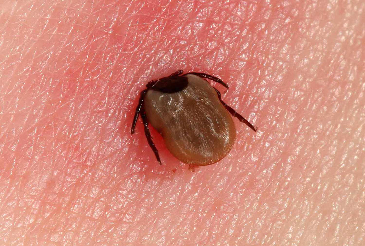 Tick bite on human skin